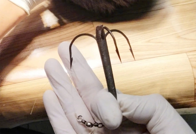 Lưỡi câu được bác sĩ gỡ ra trên đỉnh đầu bệnh nhân. Ảnh: Bệnh viện cung cấp