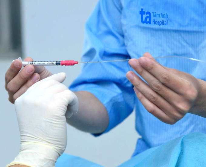 Bác sĩ IVF Tâm Anh đang chuẩn bị chuyển phôi cho người bệnh. Ảnh minh họa: Bệnh viện Đa khoa Tâm Anh Hà Nội